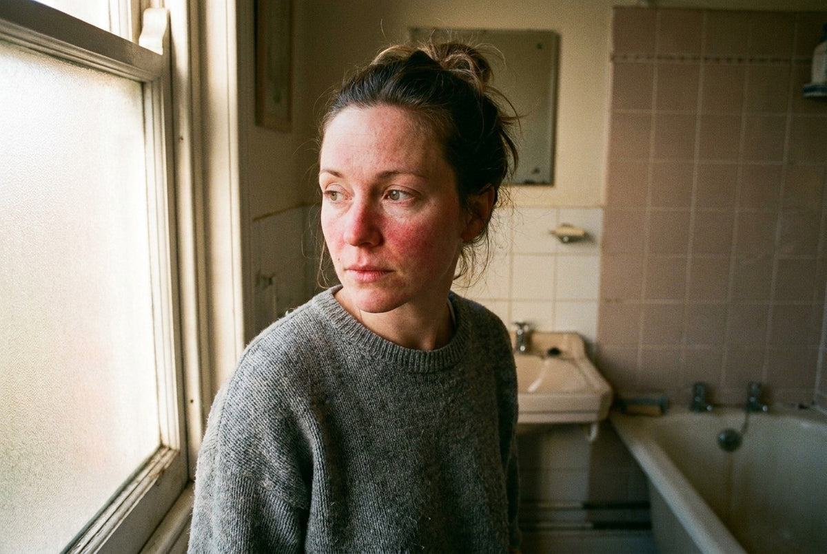 A woman in her early thirties in a bathroom in warm morning light, no makeup, visible redness across her cheeks, looking away from the camera.